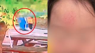 "악몽 된 어린이날"…2살 아이에 '묻지마 폭행'