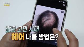 탈모 고민 시대, 헤어 나올 방법은?